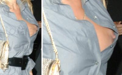pam_broken_nipple_medium.jpg