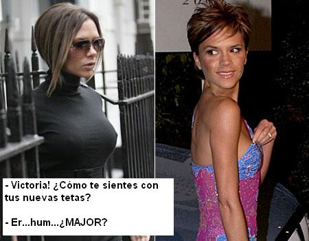 Ranking: Fug boobs » 62 Victoria Beckham fake boobs
