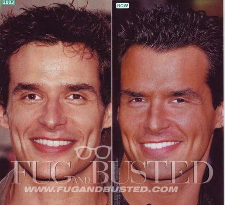 Antonio Sabato - Before and after - Then and now Mostrar imagen