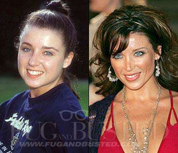 Dannii Minogue - Before and after - Then and now Mostrar imagen