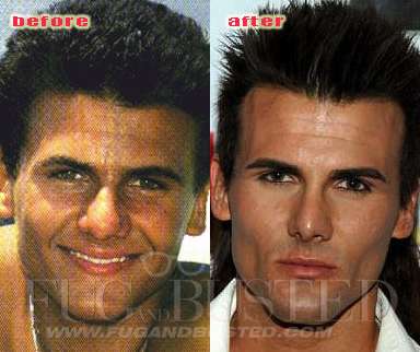 Jeremy Jackson - Before and after - Then and now Mostrar imagen