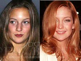 Kate Hudson - Before and after - Then and now Mostrar imagen