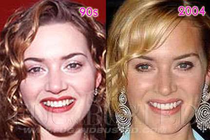 Kate Winslet Mostrar imagen