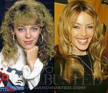 Kylie Minogue - Before and after - Then and now Mostrar imagen