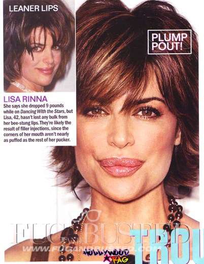 Lisa Rinna - Before and after - Then and now Mostrar imagen