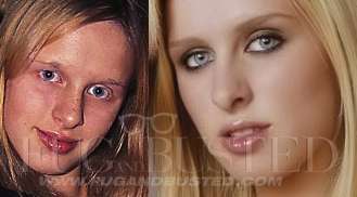 Nikki Hilton - Before and after - Then and now Mostrar imagen