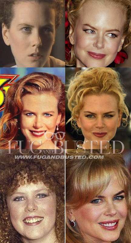 Nicole Kidman - Before and after - Then and now Mostrar imagen