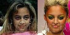Nicole Richie - Before and after - Then and now Mostrar imagen