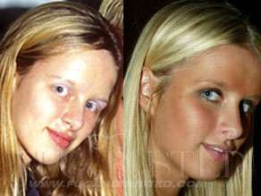 Nikki Hilton - Before and after - Then and now Mostrar imagen