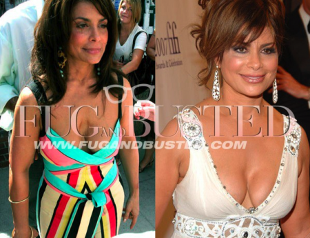 Paula Abdul's pectus excavatum Mostrar imagen