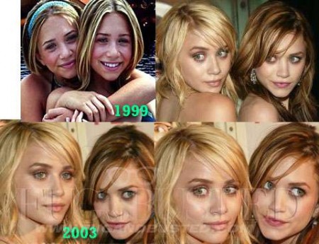 Ashley and Mary Kate Olsen - Before and after - Then and now Mostrar imagen